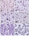 Figure 5. Immunocytochemical localization of differentiated type A spermatogonia in differential plating method using 
c-kit. The percentage of c-kit positive cells (Aggregated sperm-atogonia, dark brown and committed spermatogonia, light brown) was evaluated; A) 3 hr; B) 4 hr; C) 5 hr and D) 6 hr after culture initiation. The most purified undifferentiated spermatogonia were achieved 5 hr after culture initiation. E) Negative and F) positive controls were detected
