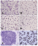 Figure 6. Immunocytochemical identification of undifferentiated type A spermatogonia by differential plating method using PGP9.5. The proportion of PGP9.5 positive cells (basal spermatogonia, dark brown, and some aggregated sperm-atogonia, light brown) C) 5 hr after culture initiation was significantly higher than; A) 3 hr; B) 4 hr and D) 6 hr after culture. E) Negative and F) positive controls were determined