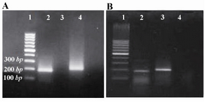 Figure 1. Fibromodolin mRNA detection in HEK293 cells A) and rat kidneys; B) by RT-PCR. A) (Lane 1) 100 bp DNA ladder, (Lane 2) Fibromodulin band (196 bp), (Lane 3) No-template control, (Lane 4)  actin band (207 bp). 
B) (Lane 1) 100 bp DNA ladder, (Lane 2) Fibromodulin band (196 bp), (Lane 3)  actin band (207 bp), (Lane 4) No-template control
