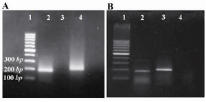 Figure 1. Fibromodolin mRNA detection in HEK293 cells A) and rat kidneys; B) by RT-PCR. A) (Lane 1) 100 bp DNA ladder, (Lane 2) Fibromodulin band (196 bp), (Lane 3) No-template control, (Lane 4)  actin band (207 bp). 
B) (Lane 1) 100 bp DNA ladder, (Lane 2) Fibromodulin band (196 bp), (Lane 3)  actin band (207 bp), (Lane 4) No-template control
