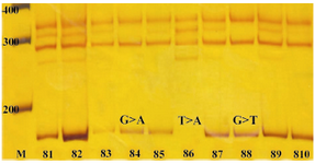 Figure 3. RAP1A. EX3 PCR products from patient's samples, M: 100 bp DNA Ladder marker; S1-S11: RAP1.EX3 PCR products from different samples; the size of PCR products are 174 bp. Two band shifts in single-strand sequences are observed at positions around 290 and 340 bp. There are 2 faint bands of single-strand sequences at positions around 265 bp and 315 bp which are not found in S4 and S8. All bands are more intense in S6