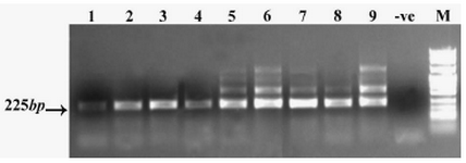 Figure 1. SORT1-specific mRNA expression (nested RT-PCR) in ovarian cancer tissue samples. Lanes 1-9 tissue samples, -ve: Negative control PCR reaction without template, M: DNA size marker. The figure represents 9 experiments out of 15. The extra bands over 225 bp are due to the overload of primary PCR reactions