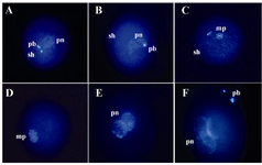 Figure 2. Nuclear morphology of sperm head after injection into the MII stage sheep oocytes stained with Hoechst, 16 hr after ICSI: A) An oocyte with two polar bodies (pb), one female pronucleus (pn), and one sperm head (sh) suggesting oocyte activation after ICSI; B) Oocyte with swollen sperm head; C) Oocyte with metaphase plate (mp); D) Oocyte with two metaphase plates; E) Oocytes with two pronuclei and without sperm head suggesting normal fertilization; F) Oocyte with three pronuclei suggesting abnormal fertilization