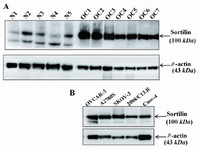 Figure 1. Western blot analysis of sortilin expression in ovarian cancer and non-malignant tissues. Seven ovarian carcinoma tissues (Table 1) as well as five ovarian carcinoma cell lines that overexpressed sortilin were compared with five non-malignant ovarian tissues (A and B). The lower band in non-malignant ovarian tissues is likely to be related to the second variant of sortilin with a molecular weight of 80-85 kDa. The level of β-actin as an internal protein loading control was detected in each sample. OC: ovarian carcinoma tissue, N: non-malignant ovarian tissue