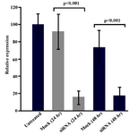 Figure 2. Real-time quantitative PCR analysis of SORT1 expression in Caov-4 cells following siRNA treatment. Results revealed 6.1 fold and 4.2 fold reduction in SORT1 expression in siRNA-transfected cells as compared to mock control-transfected cells 24 and 48 hr post-transfection, respectively (p<0.001). Values are presented as mean±SEM in 3 separate experiments