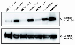 Figure 3. Western blot analysis of sortilin protein levels in siRNA-transfected cells. Densitometric analysis showed that the level of sortilin was markedly reduced by 72, 69 and 61% in siRNA-treated cells as compared to mock control-treated cells at 48, 72 and 96 hr after transfection, respectively. The level of β-actin as an internal protein loading control was detected in each sample