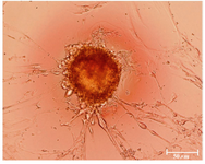 Figure 1. The cultured hUCMS cells formed numerous colonies that stained positively by alkaline phosphatase