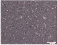 Figure 2. The hUCMS cells retained a fibroblastic cell shape with numerous cytoplasmic processes