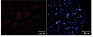 Figure 8. Immunofluorescence location of germ-cell specific markers, Ckit, in differentiated cells after 14 days treatment. Nuclei are shown in blue, DAPI staining