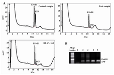 Figure 1. HPLC separation and electropherogram of the PCR products from the ErbB1 oncogene and the interferon gamma (INF&#947;) gene for the detection of the ErbB1 gene amplification. A) Chromatograms showing the results for normal DNA (control), DNA from breast tumors (test) and BT-474 breast carcinoma cell line (high copy control); B) Lanes 1, 2-3, 4 and 5 are respectively blank, controls, high copy control and DNA from primary breast carcinoma. The PCR products of INF&#947; and ErbB1 genes are very close together