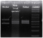 Figure 3. Results of the PCR amplification of D1S80 VNTR locus, line 1: mother; line 2: PHM of triploid dispermic; line 3: father; line 4: ladder