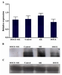 Figure 4. MKI67 mRNA and protein expressions in different groups. The control, the dietary Soy Isoflavones Extract (SIE), the intravenous docetaxel injection (DOCE) and the combination group of dietary soy isoflavone extract and intravenous docetaxel injection (DOCE+SIE) groups are shown. A) Relative expression of MKI67 gene in different groups; B) Western blot analysis of MKI67; 
C) β-actin. No significant differences between groups were detected.
