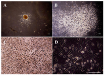 Figure 1. (A-D): undifferentiated VSELs grown on MEF cells, colony formation of VSELs after 3 days, Bar=100 µm. A) A colony of VSEL stem cells (40x); B) A colony of VSEL stem cells (100x), round bright cells are VSELs; C) a colony of VSEL stem cells (200x); D) A colony of VSEL stem cells (400x) (image was taken by Olympus IX71 inverted microscope). (Image was taken by Olympus BX51 microscope). 