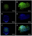 Figure 5. ICC for Glut2 and PDX1 markers in differentiated beta like cells. A) Glut2 expression was indicated by green fluorescence; B) DAPI nuclear counterstain in blue; C) Merged picture (40x); D) PDX1 was indicated by green fluorescence; E) DAPI nuclear counterstain in blue; F) Merged picture (40x). 