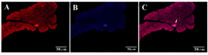Figure 6. IHC of harvested pancreas after 1 month. After tail vein injection DiI-labeled cells migrate to pancreas in diabetic mice (white arrow). A) DiI-labeled cells after migration (20x); B) DAPI for nuclear staining (20x); C) Merged. 
