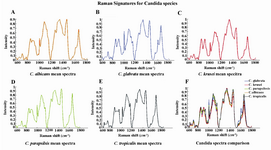 Figure 1. Mean normalized curves of the Raman signatures of the five candida species represented individually as well as compiled together.