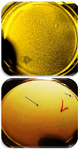 <p>Figure 2. A) Titer of recombinant nano phages in the first dilution from serial dilution, B) Titer of recombinant nano phages in the seventh dilution from serial dilution was calculated 2&times;10<sup>7</sup> <em>PFU/ml</em>.</p>