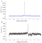 <p>Figure 3. A) MRS signal information in a voxel before water suppression. As indicated, the high peak is related to water signal. The size of other metabolites is affected by the presence of water peak. The most important step in preprocessing phase is the removal of water signal. B) the signal obtained after the removal of the water peak. As each metabolite has a definite profile, the concentration of the metabolites is obtained from the peaks of this signal.</p>