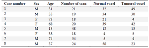 <p>Table 1. Information of the patients studied and the number of normal and tumoral voxels for each patient</p>