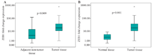 <p>Figure 1. Graphical box-plot expression profile at transcriptome level. Comparing ZEB1 expression in gastric tumor tissues with (A) adjacent non-tumor and (B) normal tissues. Results are the mean of three independent experiments&plusmn;SD (p&lt;0.05).</p>