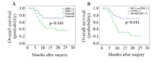 <p>Figure 3. Kaplan-Meier curves of OS for GC patients according to (A) ZEB1 expression, (B) OS for GC patients who simultaneously overexpressed ZEB1 and AR (Log-rank test).</p>