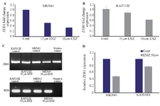 <p>Figure 4. The effects of ENZ on GC cell lines. (A, B). The effect of ENZ on ZEB1 gene expression. After 48 <em>hr</em> of treatment with ENZ (25 and 50 <em>&micro;M</em>), the GC cells were harvested for quantitative real-time PCR test. Gene expression levels were normalized to B2M. Data are given as mean&plusmn;SD. Statistically significant values of *p&lt;0.05, **p&lt;0.01, and ***p&lt;0.001 were determined compared with the control. (C) ZEB1 mRNA expression in GC cell detected by RT-PCR after 48 <em>hr</em> of treatment with ENZ (50 <em>&micro;</em>). Digital images of the gels were captured by a bio-Rad gel documentation system using Image Lab Software. The samples derived from the same experiment and gels were processed in parallel. DDW was used for negative control and genes expression in LNCaP prostate cancer cells for positive control (D) Analysis of the RT-PCR band intensity using GelQuant. NET.</p>