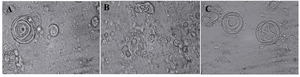 Figure 2. Morphological micrographs of niosomes (×400): A) formulation composed of Span 20/Tween 20/Cholesterol; molar ratio (m.r) 35:35:30, B) formulation composed of Span 60/Tween 60/Cholesterol; m.r 35:35:30 and C) formulation composed of Span 80/Tween 80/Cholesterol; m.r 35:35:30.