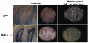 Figure 1. TSGA10 expression in rat brain
TSGA10 is expressed in different regions of rat brain including granular layer of cerebellum, hippocampus and Subventricular zone (SVZ). These brain zones are well known as the glia-rich regions of brain