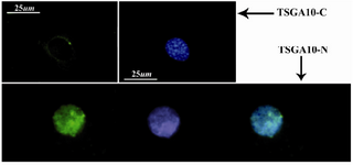 Figure 3. TSGA10 localization in astrocyte
In immunocytochemistry, TSGA10 antibody could detect the protein expression and localize the C-terminus (top panel) of the TSGA10 protein as a single perinuclear spot in the culture of astrocyte which is derived from human astrocytoma (WHO, grade III). However, the N-terminus of the protein (button panel) is expressed within the nucleus as several spots. DAPI used for the nuclei staining and FITC-conjugated (green) secondary antibody was used in IF