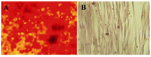 Figure 2. The in vitro osteogenic differentiation of hAM-MSC. A) The osteogenic differentiation of hAM-MSC was followed by Alizarin red S staining. B) Red calcium deposits could not be seen in negative control that was cultured in the absence of the differentiation medium.