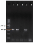 Figure 2. PCR by sY1191 primer. Number 3 and 5 samples have b2/b3 deletion.