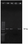 Figure 3. PCR by sY1291 primer. Sample number 7 has a gr/gr deletion