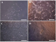 Figure 1. Morphologic features of Wharton's Jelly-Mesenchymal Stem Cells (WJ-MSCs). A) MSCs isolated from WJ with heterogeneous flattened fibroblast-like characteristics, B) cell expansion with homogenous form, C) and further expansion, D) morphology of colony forming cells (Invert microscope, Scale bar=100 µm).