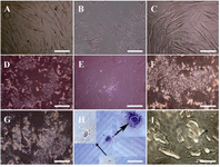 Figure 3. Hepatocyte-like cells morphological features. A) Serum free cells show no conspicuous growth alteration, B) short appendage flattened in cells exposed to RA as a contrast with C) not exposed cells after two weeks, D) after three weeks, polyhedral shapes were detected in exposed cells despite of E) not exposed cells, F) at the end of week’s four, more visible granules appeared in cells receiving RA than G) not receiving cells, H) morphology of two hexagonal HLCs stained with hematoxylin followed by I) further bile canaliculi-like (arrow) development in exposed cells. All observed with invert microscope. Scale bars for A, B and C=10 µm; for D, E, F, and G=100 µm; for H=20 µm; and for I=50 µm.