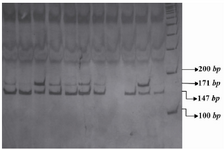 Figure 1. PCR- RFLP profile of IL16 rs11556218 T/G polymorphism digested with NdeI restriction enzyme.
