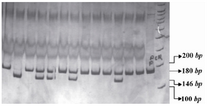 Figure 2. PCR- RFLP profile of IL16 rs4778889 T/C polymorphism digested with AhdI restriction enzyme.