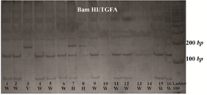 Figure 1. TGFA BamHI RFLP. Three genotypes from CL/P cases demonstrating the wild type (W), Heterovariant (H) and HomoVariant (V). After digestion with the restriction enzyme BamHI, the amplified product was completely digested with one restriction site and two specific bands of 120 bp and 54 bp were indicated in wild type genotype.