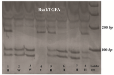 Figure 2. TGFA RsaI RFLP. Three genotypes from CL/P cases demonstrating the wild type (W), Heterovariant (H) and Homovariant (V). After digestion with the restriction enzyme RsaI, the amplified product was completely digested with one restriction site and two specific bands of 91 bp and 75 bp were indicated in wild type genotype.