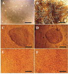 Figure 1. Phase contrast microscopy images of A) MEFs (Scale bar= 200 <i>µm</i>); B) hMSCs (Scale bar=100 <i>µm</i>); C) hiPSC colones on MEFs feeder (Scale bar=200 <i>µm</i>); D) hiPSC colonies on hMSCs feeder (Scale bar=200 <i>µm</i>); E) differentiated hiPSCs using protocol 3 and MEFs feeder (Scale bar=800 <i>µm</i>); F) differentiated hiPSCs using protocol 5 and hMSCs feeder (Scale bar=800 <i>µm</i>).