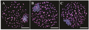 Figure 1. Differential staining of resulting blastocysts supplemented with (images B and C, respectively) and without aldosterone (image A) during IVM and day 4 of IVC. The inner cell mass nuclei and trophectoderm cells were stained blue and pink, due to staining with Hoechst and PI (Propidium iodide), respectively.