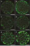 Figure 2. Angiotensin II supplementation during IVM and IVC and its effect on Na<sup>+</sup>/K<sup>+</sup>/ATPase α<sub>1</sub> and β<sub>1</sub> subunits expression in derived embryos. Bright green color in each micrograph indicates the presence of α<sub>1 </sub>and β<sub>1</sub> Na<sup>+</sup>/K<sup>+</sup>/ATPase subunits probed by respective primary antibodies (anti-α<sub>1</sub> and anti- β<sub>1</sub> Na<sup>+</sup>/K<sup>+</sup>/ATPase) which have been subsequently identified by secondary antibody conjugated with fluorescein isothiocyanate. Bars, 40 <i>µm</i>. The intensity of Na<sup>+</sup>/K<sup>+</sup>/ ATPase α<sub>1</sub> and β<sub>1 </sub>subunits in embryos of control group (A and B, respectively). Expression of Na<sup>+</sup>/K<sup>+</sup>/ATPase α<sub>1</sub> subunit in embryos that were exposed to Ang II during IVM (C). Expression of Na<sup>+</sup>/ K<sup>+</sup>/ATPase β<sub>1</sub> subunit in embryos that were exposed to Ang II during IVM (D). Expression of Na<sup>+</sup>/K<sup>+</sup>/ATPase α<sub>1</sub> subunit in embryos that were exposed to Ang II during day 4 of IVC (E). Expression of Na<sup>+</sup>/K<sup>+</sup>/ATPase β<sub>1</sub> subunit in embryos that were exposed to AngII during day 4 of IVC (F).