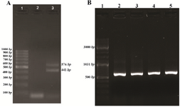 Figure 1. A) PCR amplification of VEGF<sub>165</sub> gene from cDNA on agarose gel 1.5%. Lanes 1: 100 <i>bp</i> DNA ladder, 2: negative control and 3: PCR products of cDNA. B) PCR screening of the recombinant plasmid VEGF<sub>165</sub>_pET32a(+) on agarose gel 1.5%. Lanes 1: 100 <i>bp</i> DNA ladder, 2-5: PCR products.