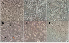 Figure 2. Cytomorphological alterations of HeLa cells treated with brittle star alcoholic extract. A) Control (without treatment) indicated accumulation of HeLa cells uniformly. (B, C, D, E, F) HeLa cells treated with 12.5, 25, 50, 100, 200 <i>µg/ml</i> extract for 48 <i>hr</i> indicate apoptotic features such as cytoplasmic blebbing (orange arrows), round shape (black arrows) and apoptotic body formation (white arrows), respectively. Magnification=×400.