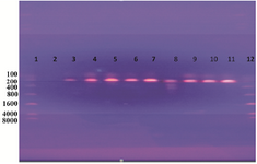 Figure 1. DNA amplification of a 204 <i>bp</i> of <i>Salmonella</i> spp. Detecting <i>ompC </i>gene using PCR. Lane 1: ladder; lane 2: negative; lanes 3, 4, 5, 6, 7, 8, 9, 10, and 11: positive results as <i>Salmonella </i>spp.; lane 12: 8000 <i>bp</i> marker (Ladder).