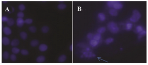 <p>Figure 9. DAPI stained image of HeLa cells after treatment with GNPs. Choromatin fragmentation is shown with arrow.</p>