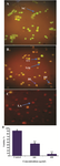 <p>Figure 10. Comparison of EB/AO method for HeLa suspension cells.&nbsp;HeLa cells were treated with A) 0, B) 100 <em>&mu;g/ml</em> and C) 400 <em>&mu;g/ml</em> of GNPs for induction of apoptosis. Representative micro-graphs showing quantification of cells viability after 48 <em>hr</em> of treat-ment with 0, 100 and 400 <em>&mu;g/ml</em> of GNPs D). The cells were introduced as normal cells (NC), early apoptotic cells (EA), late apoptotic (LA) after 48 <em>hr</em> of treatment showing membrane blebbing (BL), chromatin condensation (CC), blebbing and nuclear margination (MN), DNA fragmentation (DF) and apoptotic body formation after 48 <em>hr</em> of treatment using arrows. The values are shown as mean&plusmn;SD.</p>