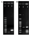 <p>Figure 1. A) PCR amplification of 167 <em>bp</em> EDC 1. 50 <em>bp</em> DNA ladder. 2. Negative control, 3. EDC, B) PCR amplification of 414 <em>bp</em> ACTB as an internal (cfDNA) control. 1. 100 <em>bp</em> DNA ladder, 2. Genomic DNA, 3. Plasmid DNA containing ACTB fragment.</p>