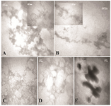 <p>Figure 2. TEM images of A) HSA; B) GHSA; C) GHSA+&beta;-CyD; D) GHSA+Tre; E) GHSA+Alg; after 30 <em>min</em> incubation in 50 <em>mM</em> Tris buffer, pH=7.4 at 65<em>&deg;</em><em>C</em> and DTT.</p>
