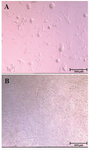 <p>Figure 1. Colonization of SSCs in the control group; A) versus absence of colony formation in the germ-cell removed group; B) on day 12 of culture.</p>

