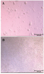 <p>Figure 1. Colonization of SSCs in the control group; A) versus absence of colony formation in the germ-cell removed group; B) on day 12 of culture.</p>
